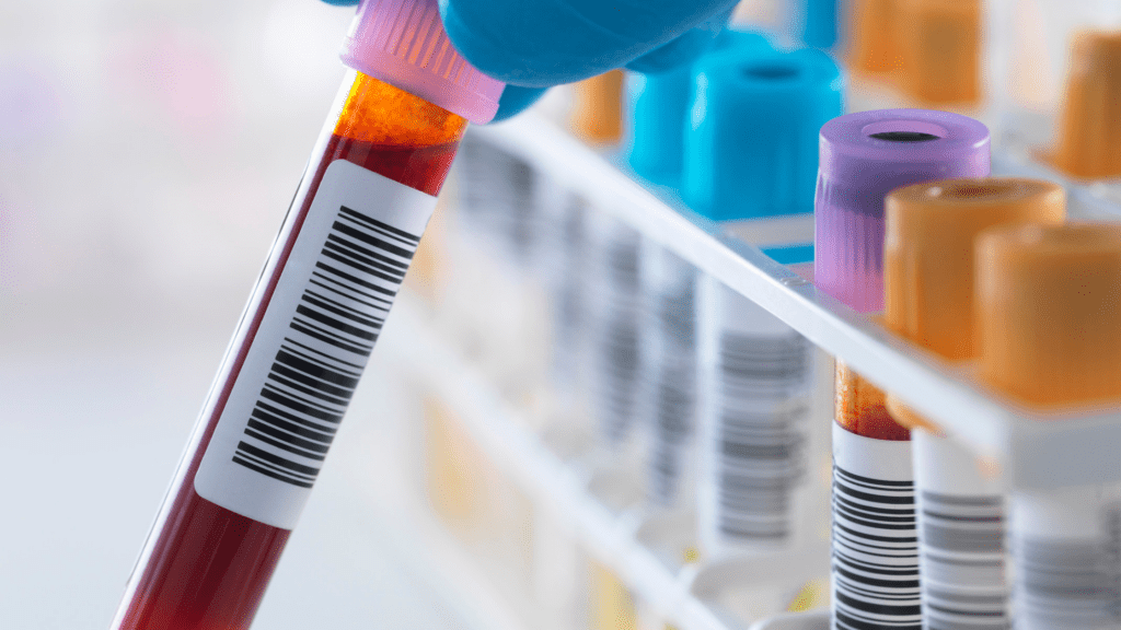 Blood sample
