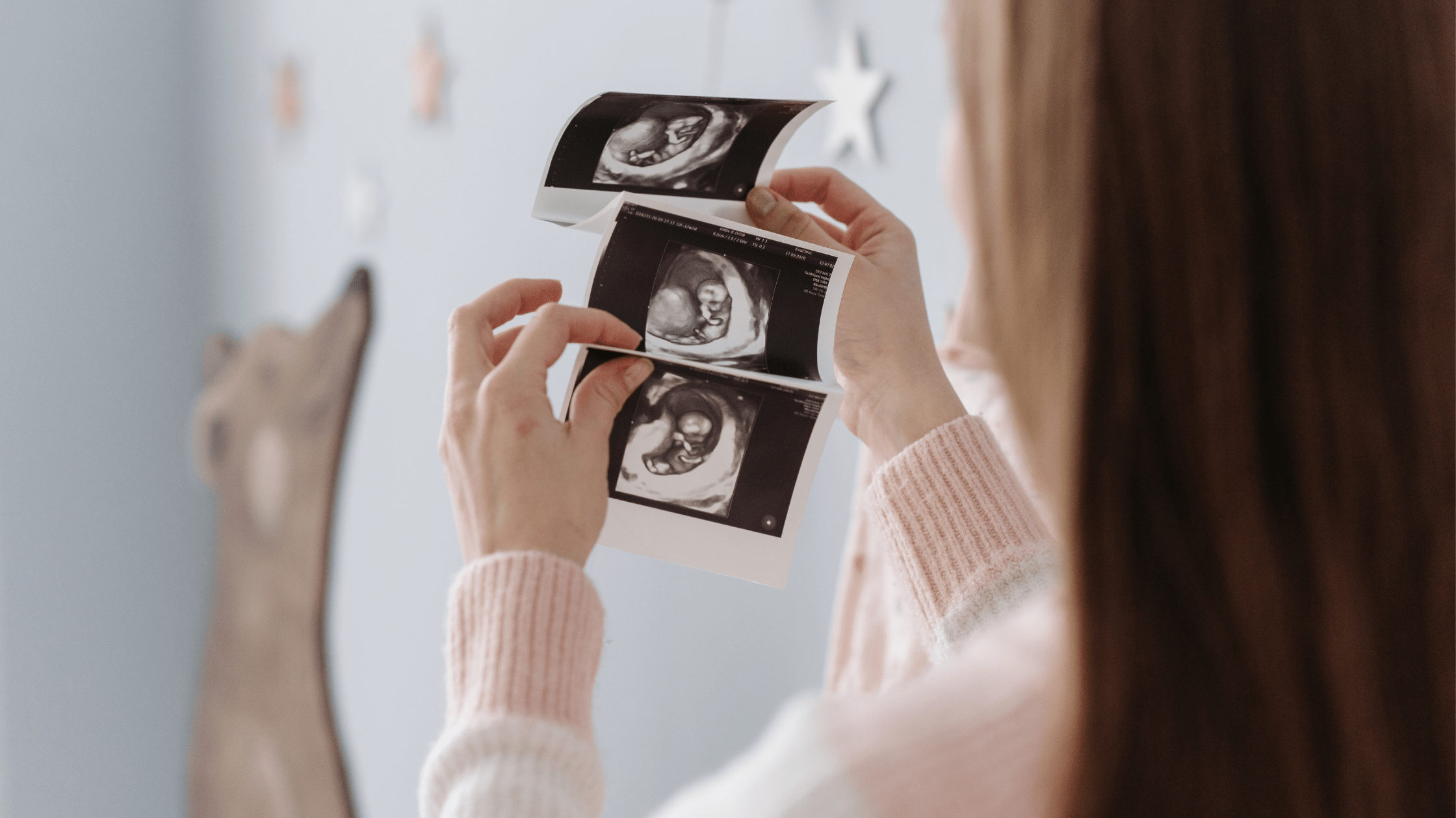 Women looking at baby scans